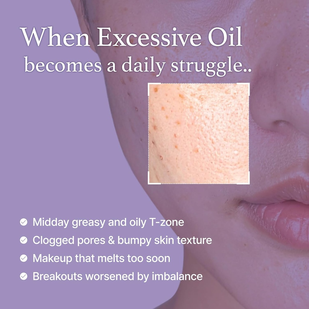I'm from/ Black Rice Toner for Oily Skin: